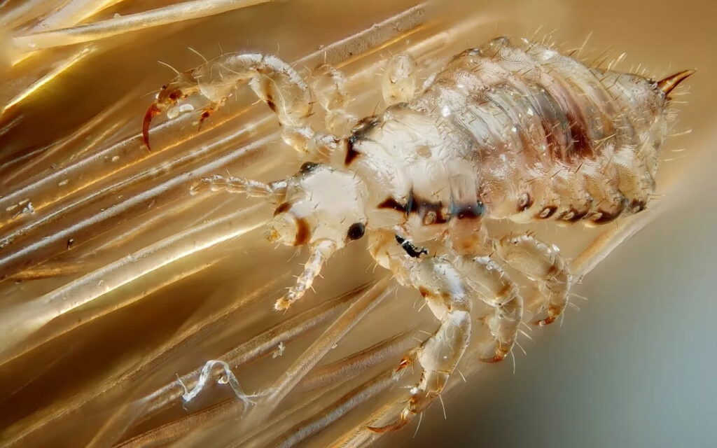 Як зрозуміти, що в тебе воші